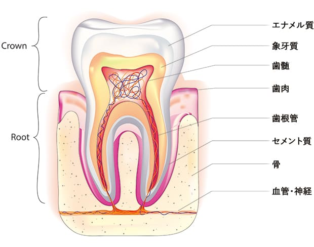 歯の根の病気の種類