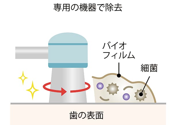 バイオフィルムを防ぐには？