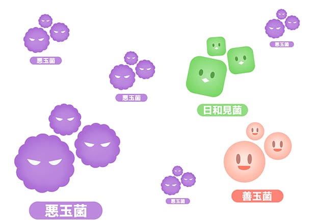 細菌バランスを崩すマイクロバイアルシフト