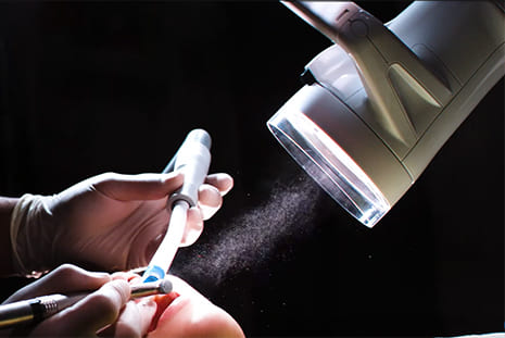 口腔外バキューム